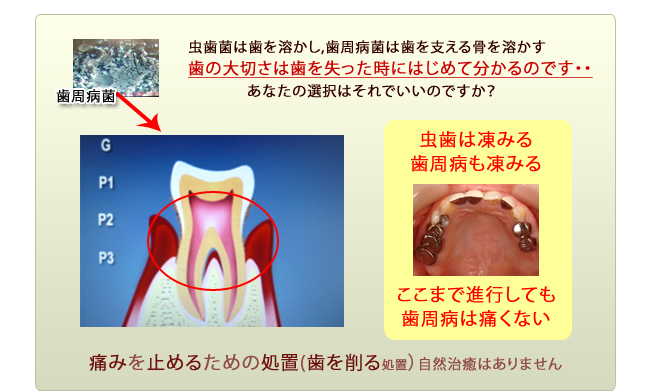 歯科の最先端の治療法