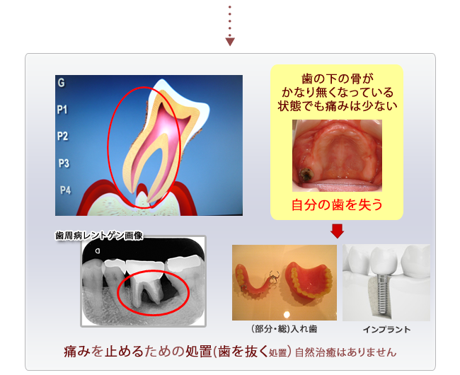 歯科の最先端の治療法